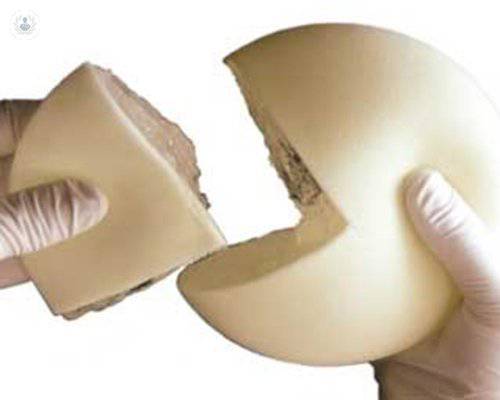 Ventajas de los implantes mamarios de poliuretano