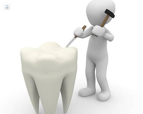 Principales aplicaciones de la endodoncia