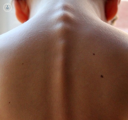 articulacion-facetaria