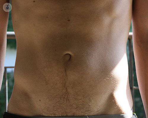 Cómo reducir el abdomen mediante cirugía