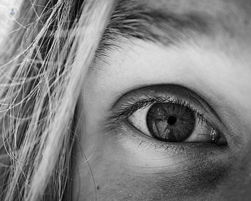 blefaroplastia-sin-cirugia