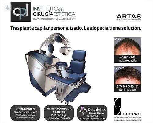 Innovación en el tratamiento de la alopecia