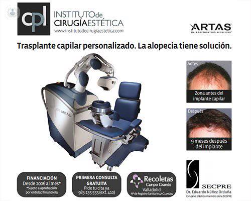alopecia-tratamiento-avances