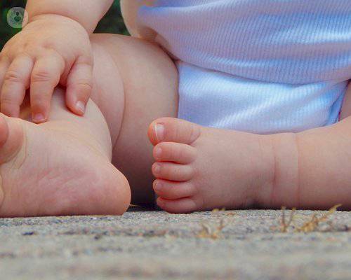 Angulación de las rodillas, una preocupación habitual para los padres