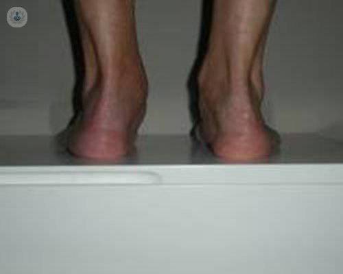 tendon-tibial-posterior