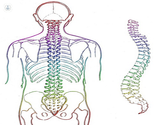 Ventajas de la vertebroplastia: ¿cómo y cuando realizarla?