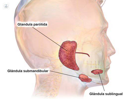 Antes y después de la cirugía de glándulas salivales