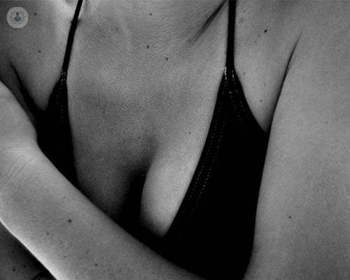 reconstruccion-mamaria