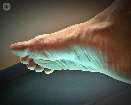 Cirugía del pie mínimamente invasiva