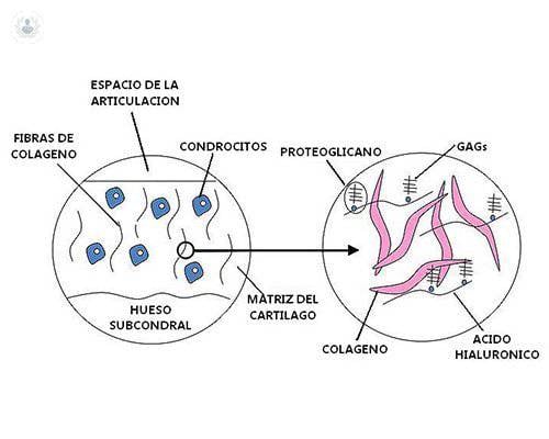 acido-hialuronico-articulaciones