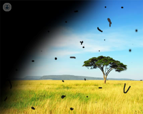 destellos-luminosos-retina