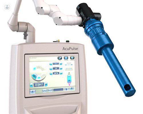 laser-femtouch-para-salud-vaginal