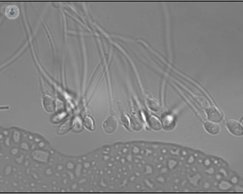espermatozoides