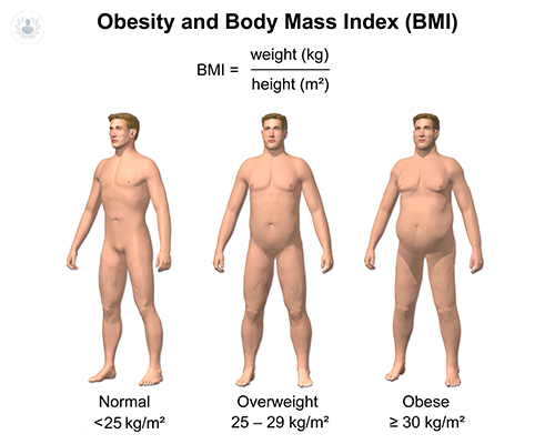 Resultados del By-pass Gástrico contra la obesidad