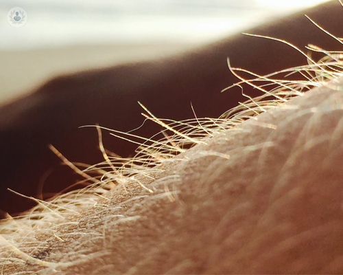 tratamiento-para-la-sarna