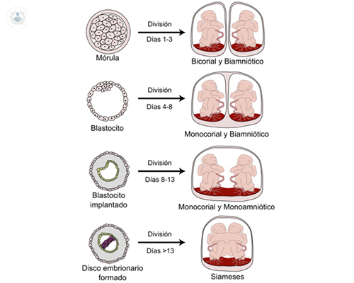 imagen-gestacion-gemelos