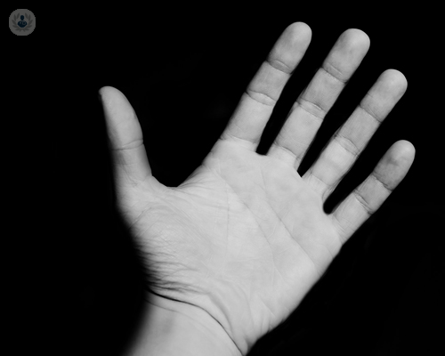Fractura de mano: por qué es importante tratarla