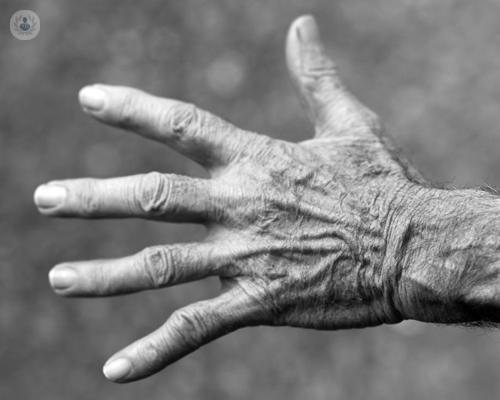 Les artritis: Tot el que cal saber