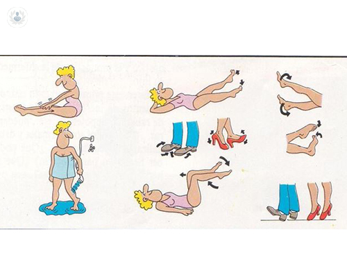 varices-en-verano