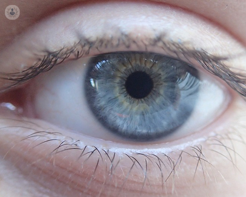Epifora: por qué se produce el lagrimeo u ojos llorosos