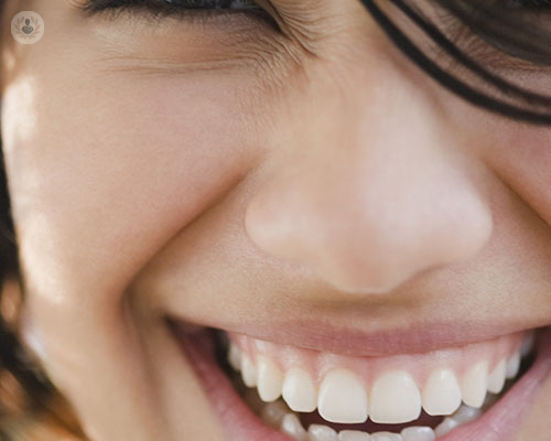 5 características de los implantes dentales