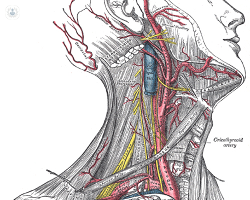 tea-carotidea-tromboendarterectomia-esternoclestomastoideo-cuello-intervencion-endarterectomia