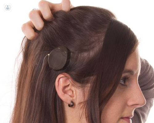 Implante coclear, el presente de la audición