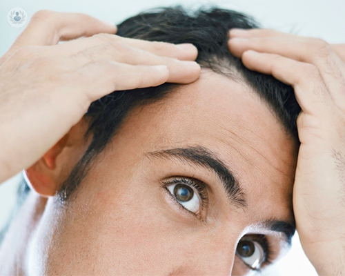 factores-de-crecimiento-la-solucion-contra-la-alopecia