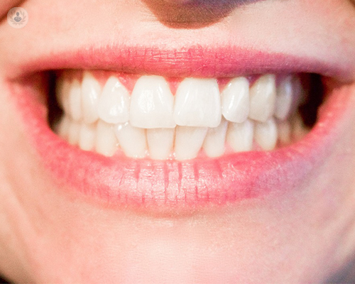 Adhesivos para prótesis dentales: ¿funcionan?