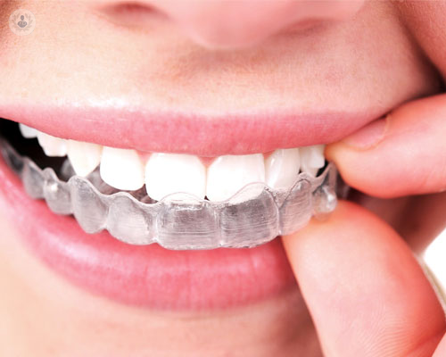 invisalign