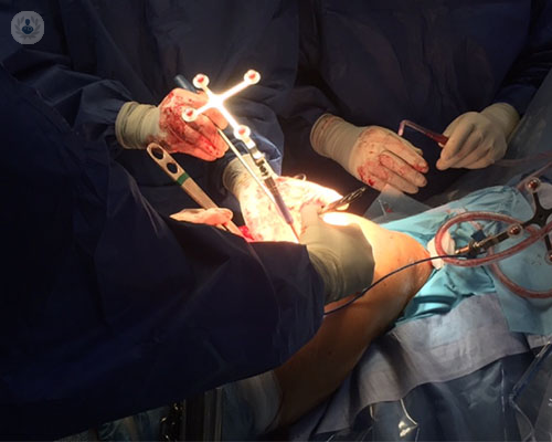 artroplastia-total-de-cadera