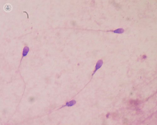Fragmentación del ADN en espermatozoides