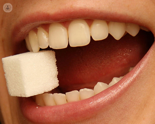 causas-de-las-caries