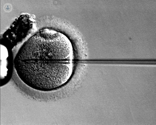 fecundacion-in-vitro