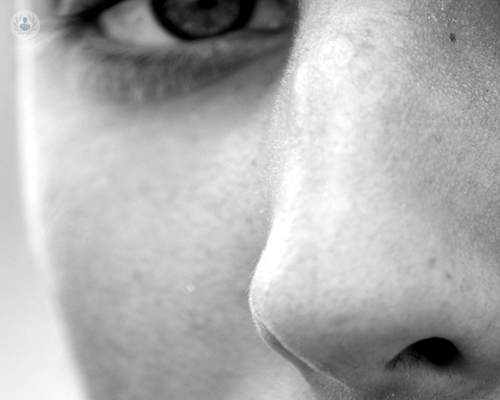 tabique-nasal