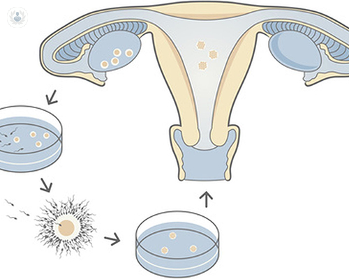 fecundacion-in-vitro
