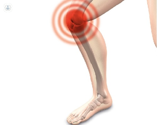 Vías de tratamiento para la artrosis de rodilla
