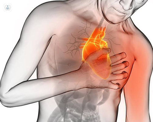 Actuar rápido ante los síntomas del infarto y del ictus puede salvar tu vida