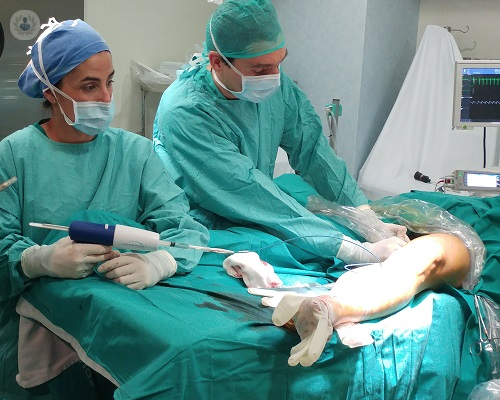 tratamiento-de-varices-con-venaseal