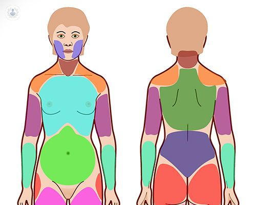 ozonoterapia-fibromialgia