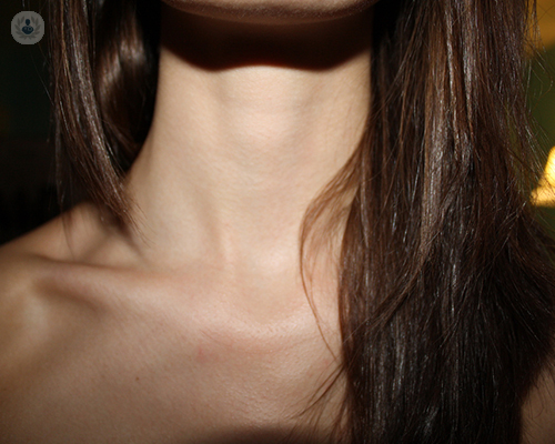 como-acabar-con-la-papada