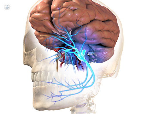 neuralgia-del-trigemino
