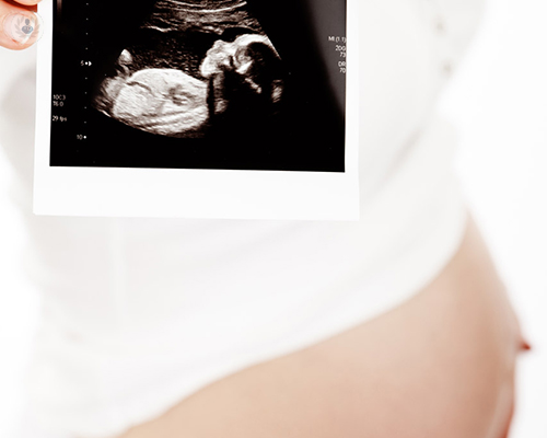 ecografia-embarazo
