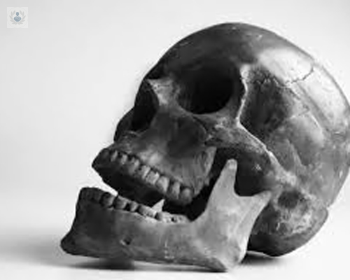 traumatismos-faciales