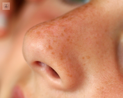 cirugia-de-la-nariz-cirugia-estetica