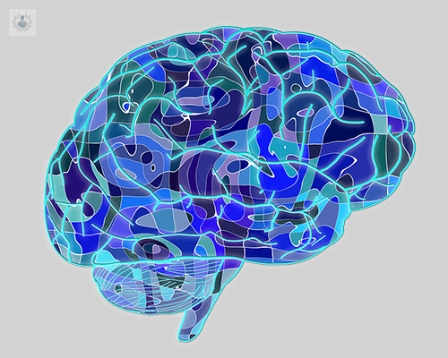 prevenir-embolia-cerebral