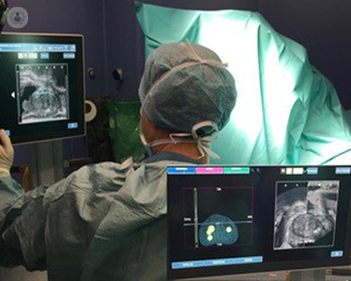 biopsia-fusion-salud