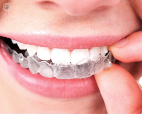 Invisalign, la nueva solución invisible para tus dientes