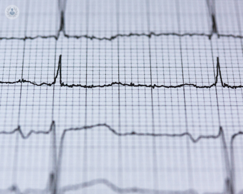 enfermedades-cardiovasculares