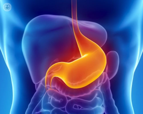 esfinter-esofago-y-reflujo